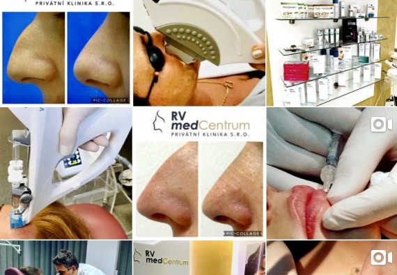 SLEDUJTE NÁS NA INSTAGRAMU!