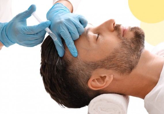 NOVINKA! VLASOVÁ MEZOTERAPIE KMENOVÝMI BUŇKAMI