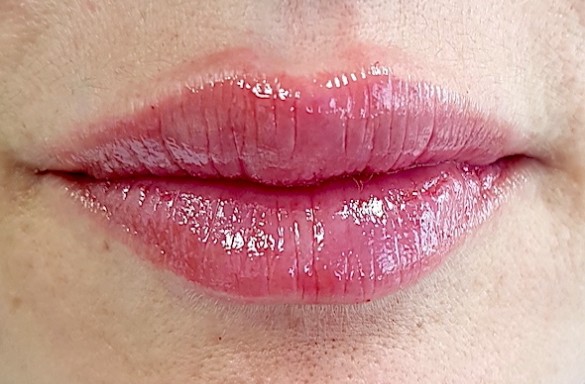 Bezprostředně po aplikaci