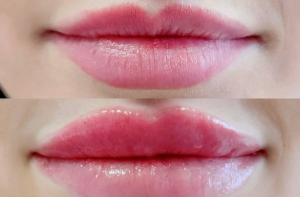 Před a bezprostředně po aplikaci