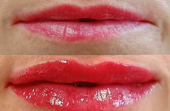 Před a bezprostředně po aplikaci