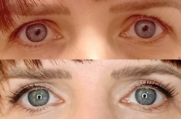 Plastika horních víček