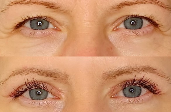 Plastika horních víček