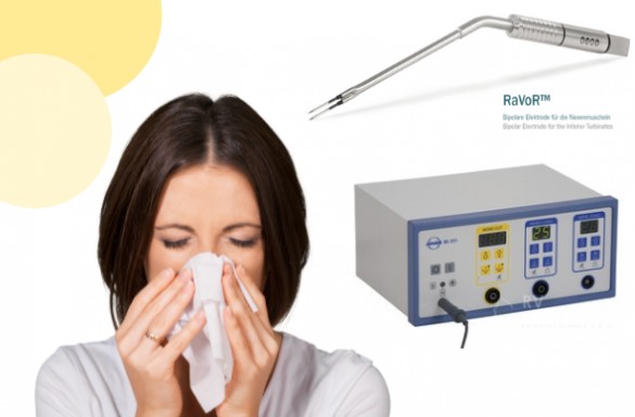 Turbinoplastika radiofrequenčním přístrojem (RaVoR)