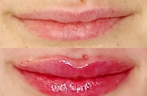 Před a bezprostředně po aplikaci